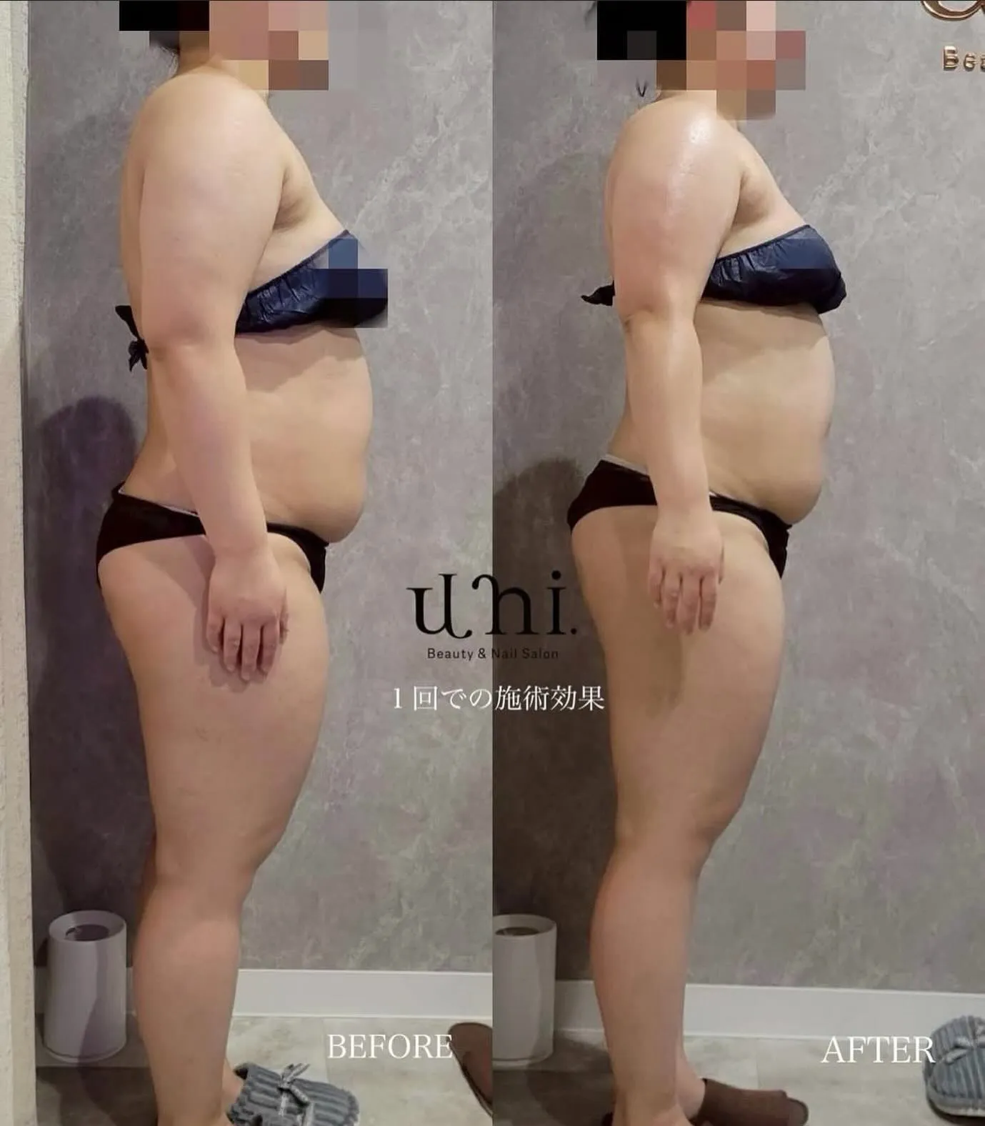 ヘビー級ダイエットプラン症例🔥